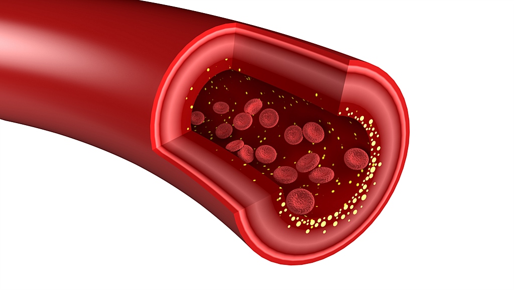 Natural Ways to Lower Cholesterol - by the Numbers